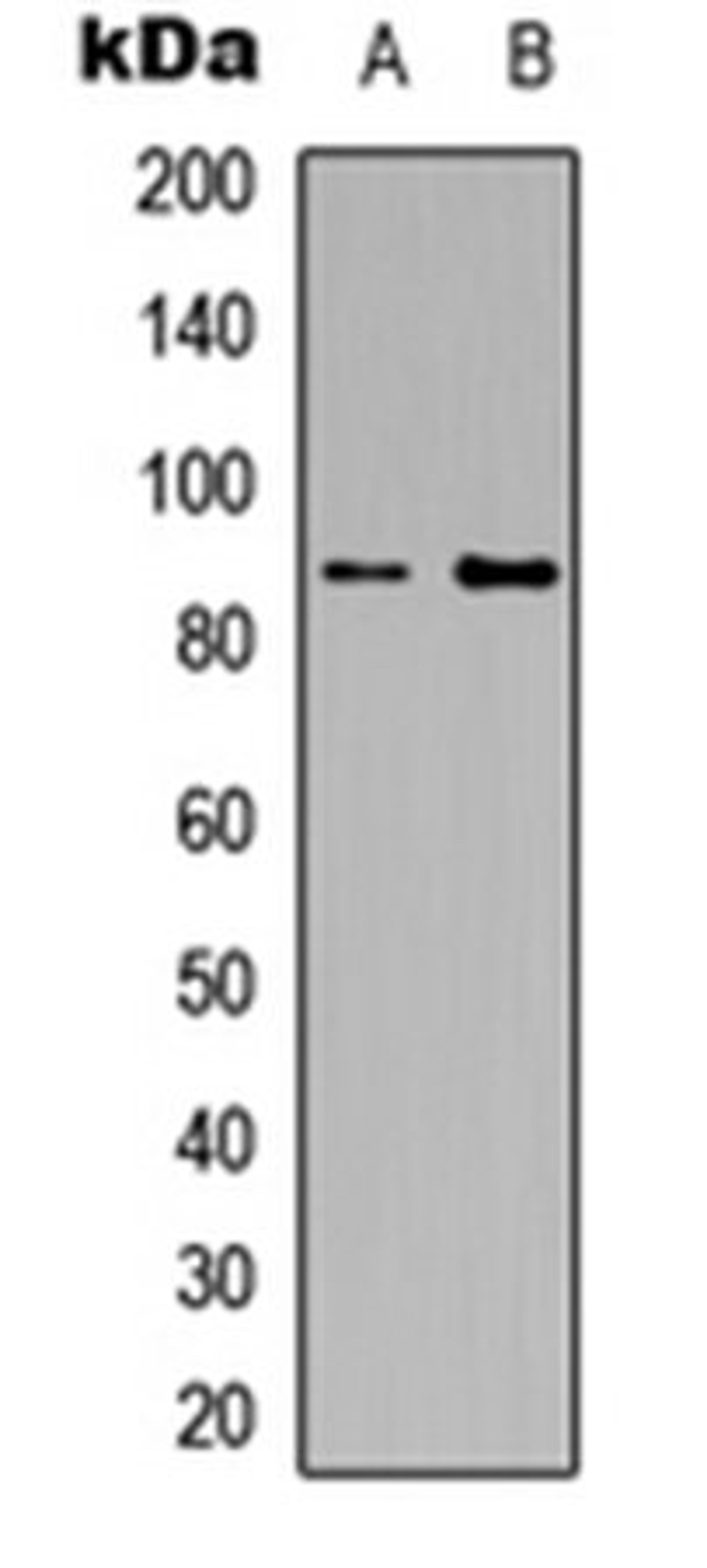 Western blot analysis of HEK293T (Lane1), Raw264.7 (Lane2) whole cell using CD124 antibody