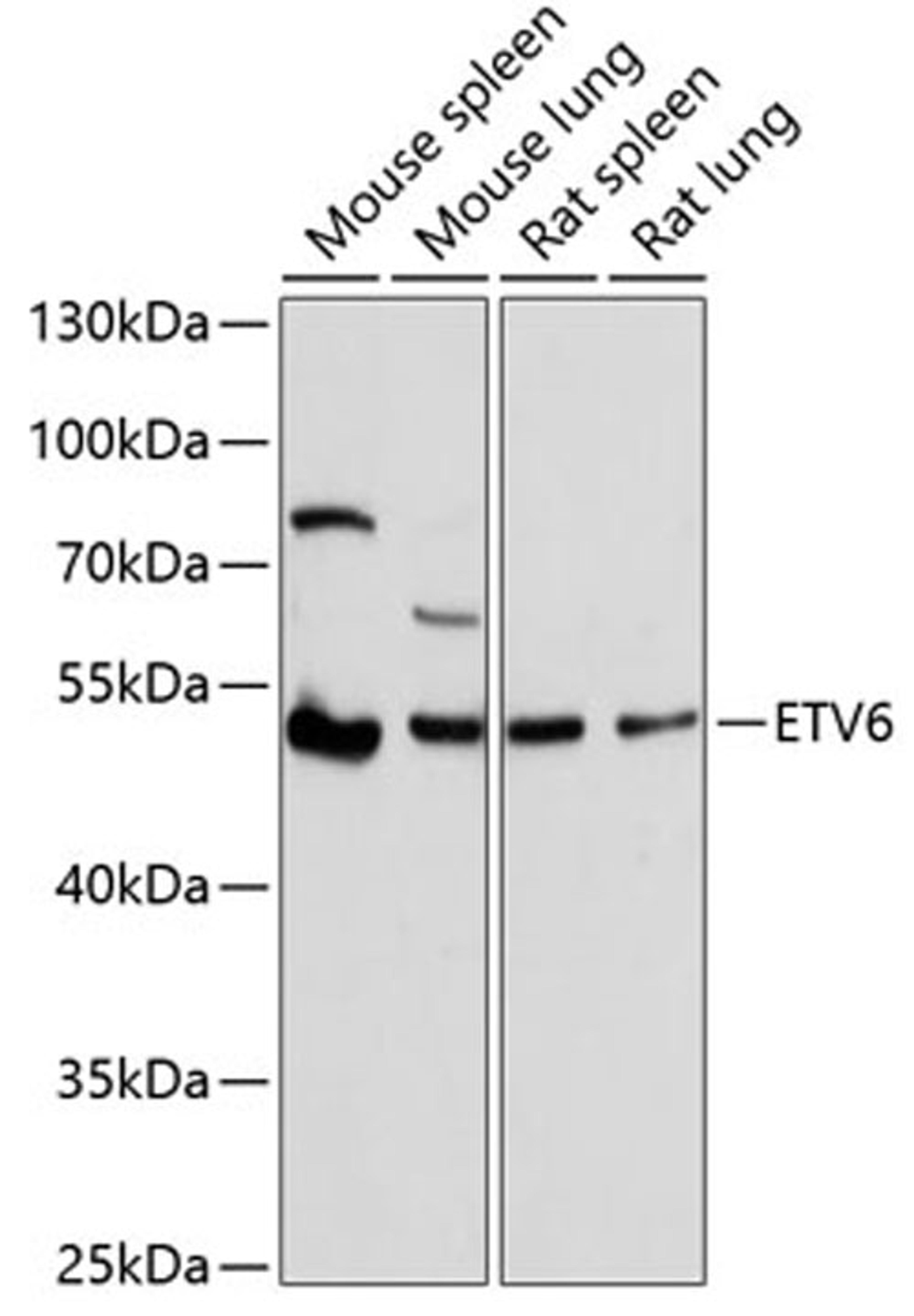 Western blot - ETV6 antibody (A1637)