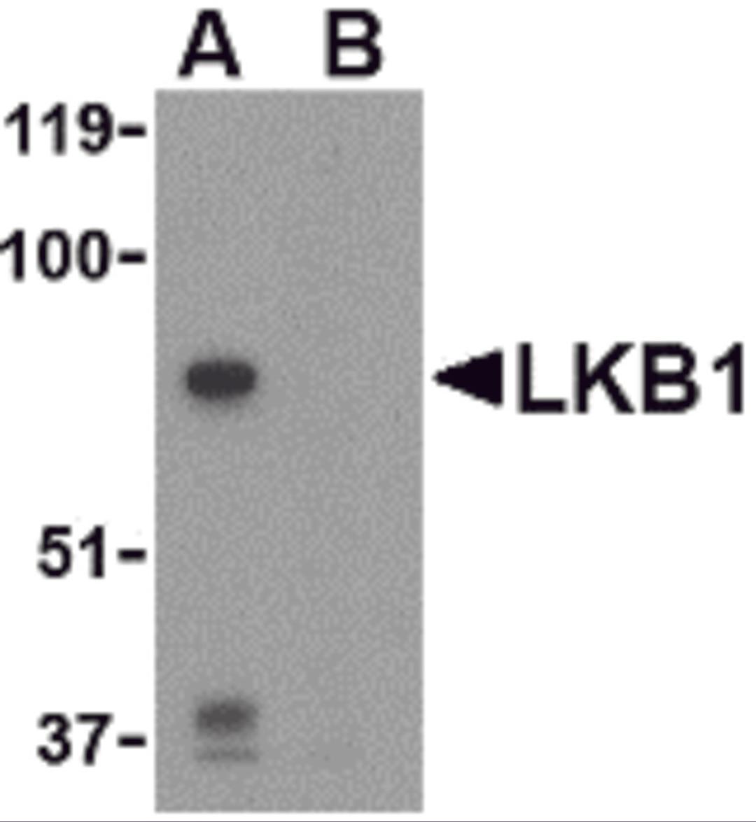 Western blot analysis of LKB1 in PC-3 cell lysate with LKB1 antibody at 1 μg/mL in the (A) absence or (B) presence of blocking peptide.
