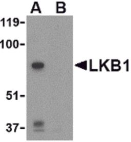 Western blot analysis of LKB1 in PC-3 cell lysate with LKB1 antibody at 1 μg/mL in the (A) absence or (B) presence of blocking peptide.