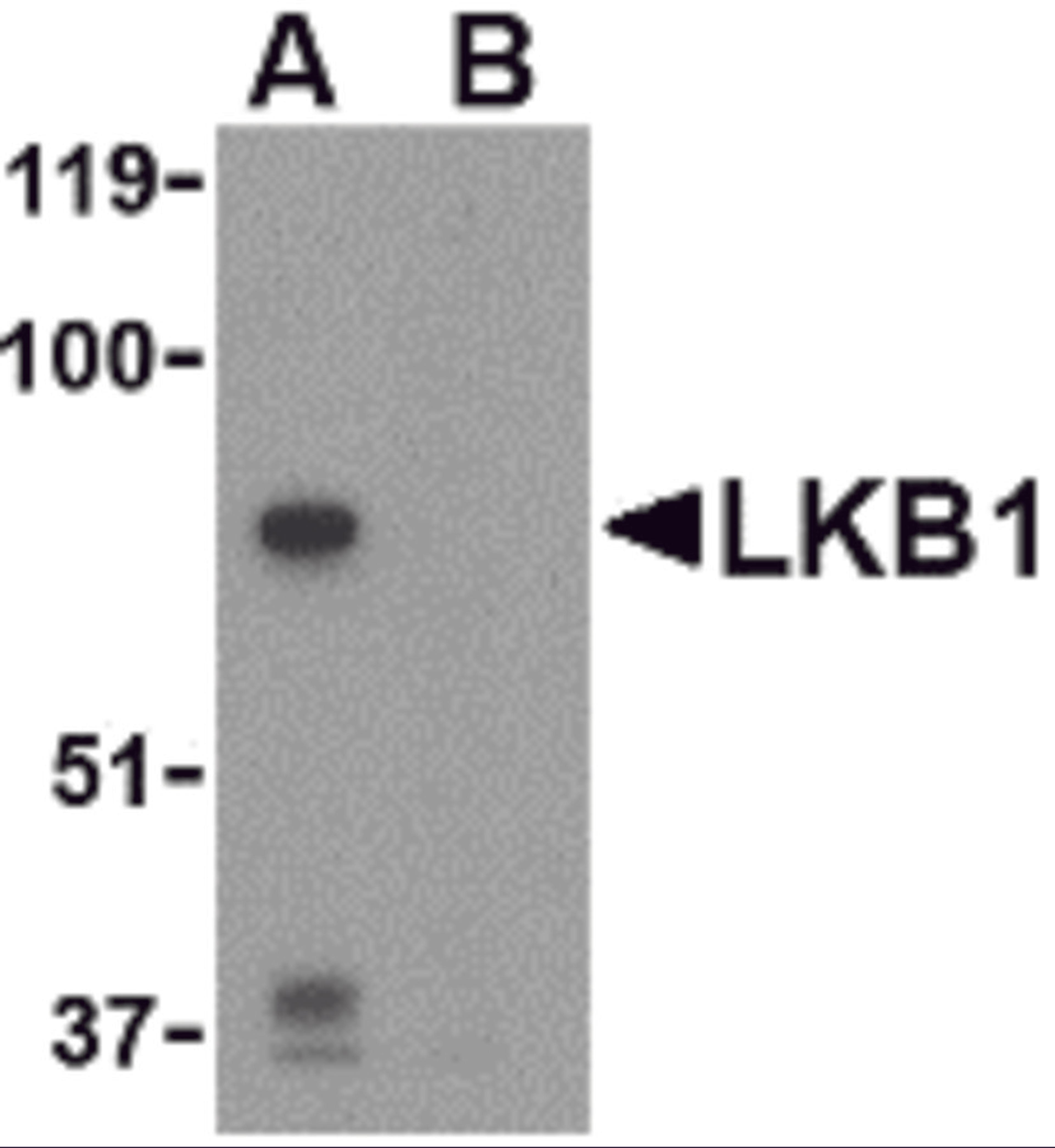 Western blot analysis of LKB1 in PC-3 cell lysate with LKB1 antibody at 1 μg/mL in the (A) absence or (B) presence of blocking peptide.