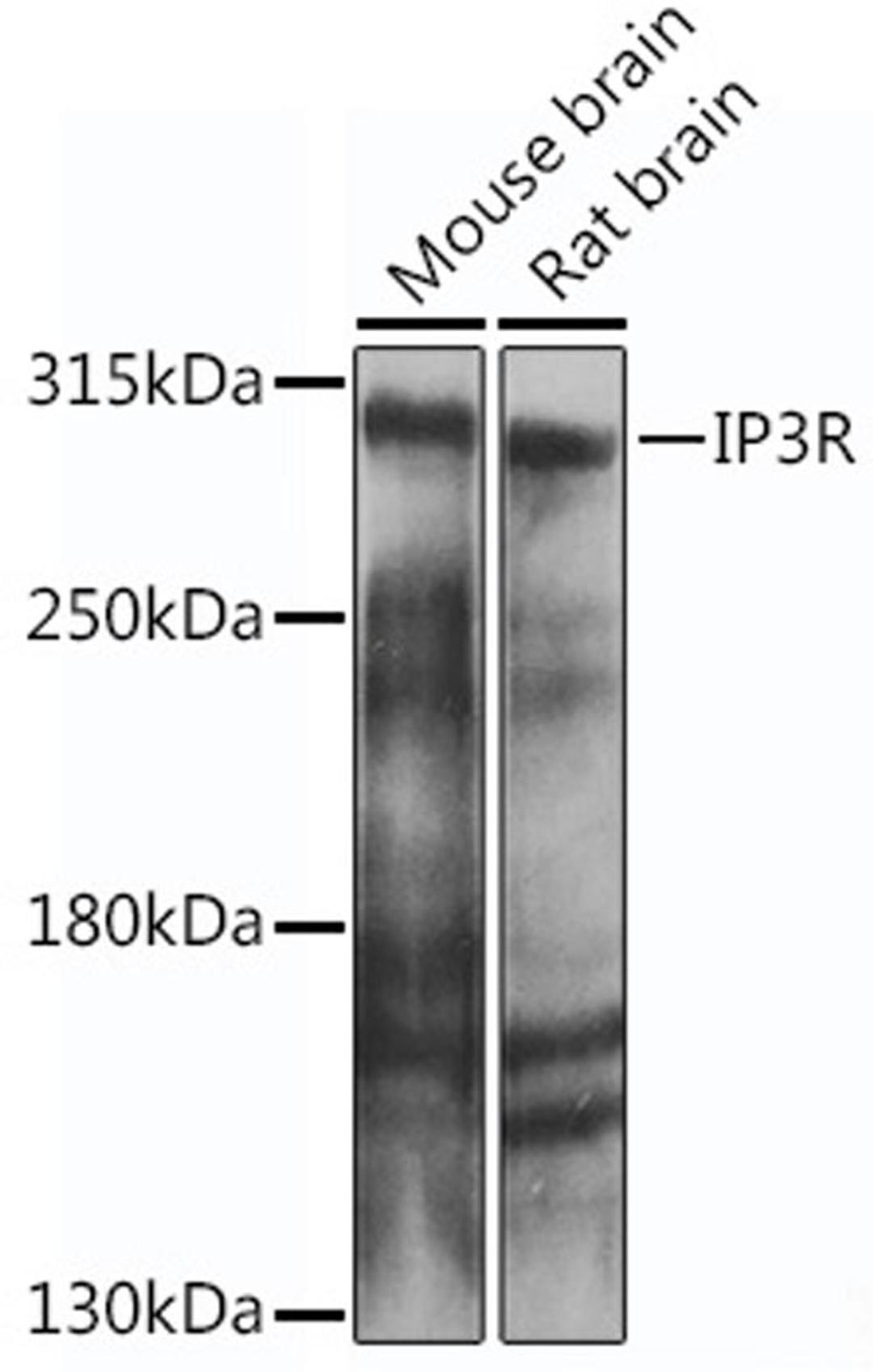 Western blot - IP3R antibody (A14008)