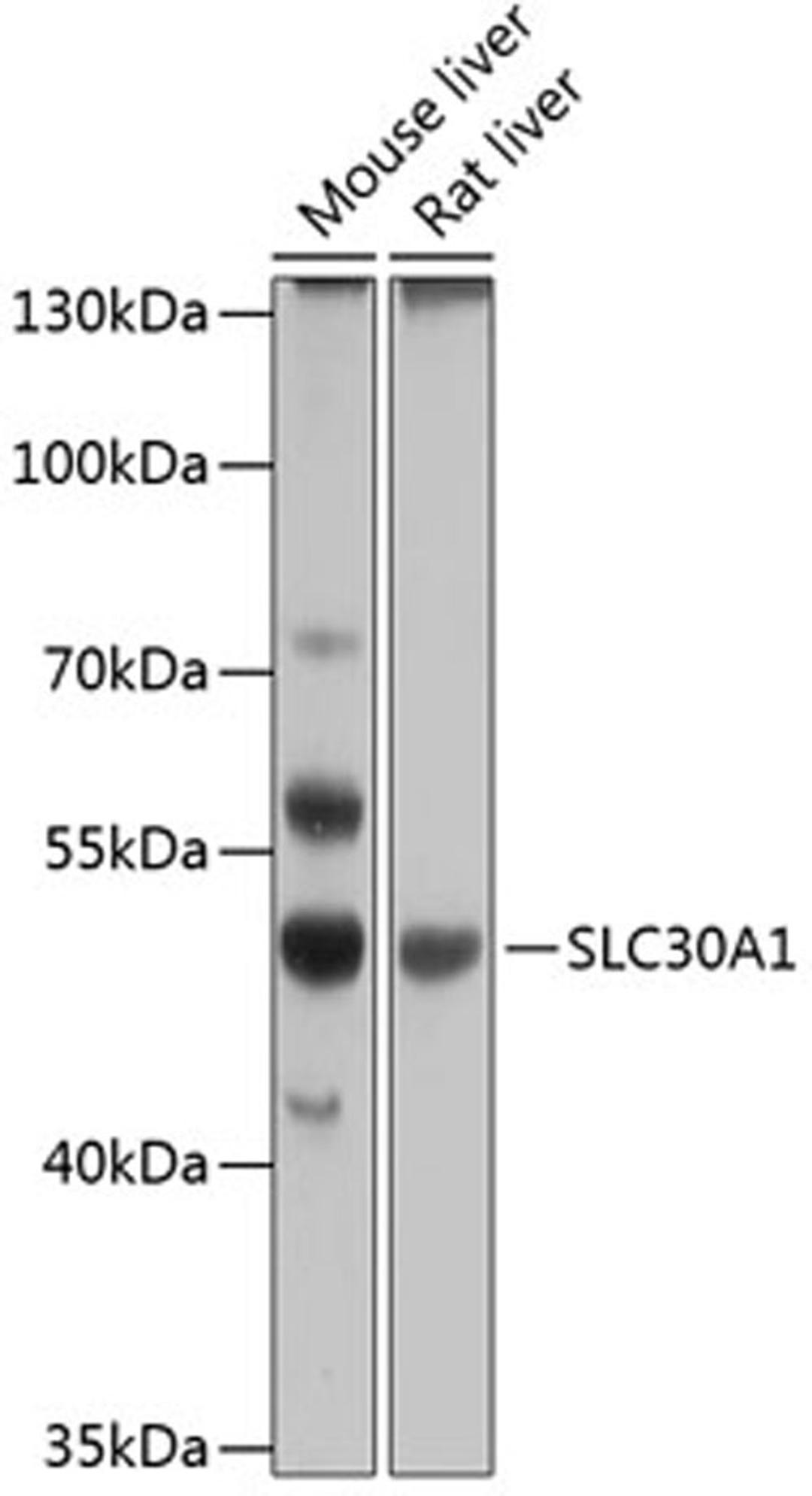 Western blot - SLC30A1 antibody (A12533)