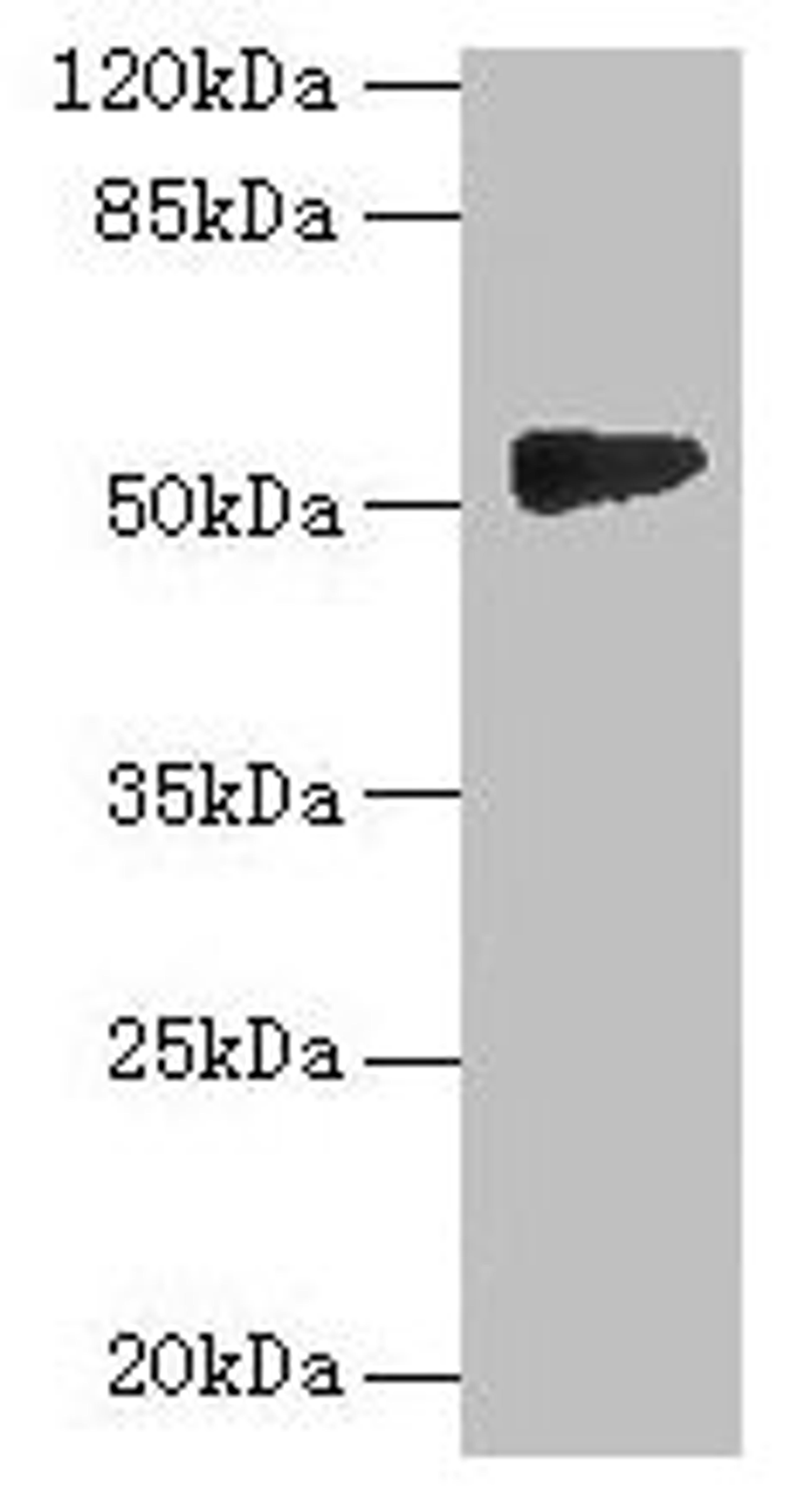 Western blot. All lanes: GTDC1 antibody at 4µg/ml + A549 whole cell lysate. Secondary. Goat polyclonal to rabbit IgG at 1/10000 dilution. Predicted band size: 53, 44, 34, 50, 38 kDa. Observed band size: 53 kDa