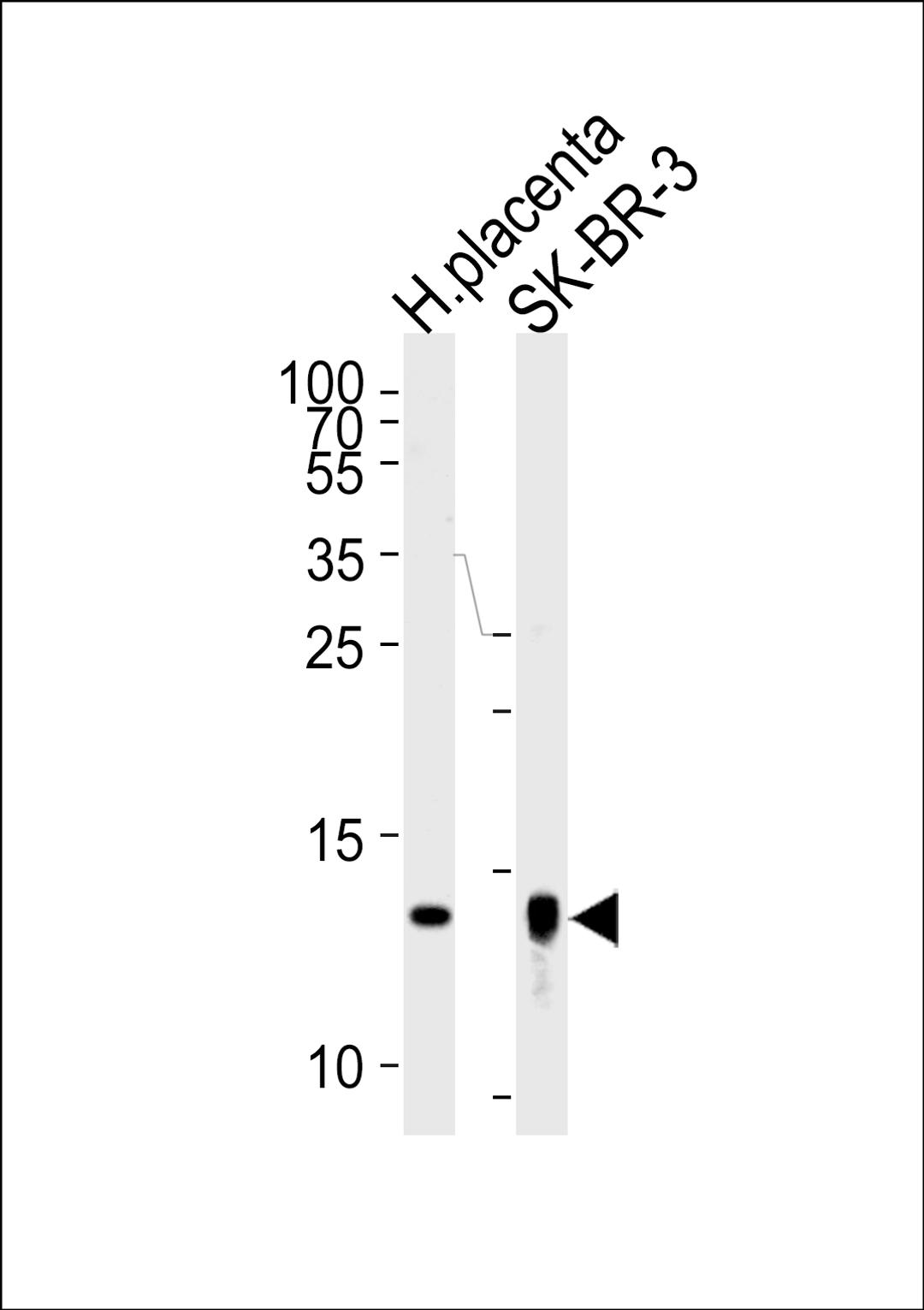 Western blot analysis of lysates from human placenta tissue lysate, SK-BR-3 cell line (from left to right), using Trx2 Antibody (I151) at 1:1000 at each lane.