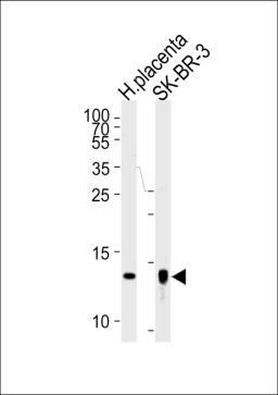 Western blot analysis of lysates from human placenta tissue lysate, SK-BR-3 cell line (from left to right), using Trx2 Antibody (I151) at 1:1000 at each lane.