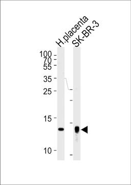 Western blot analysis of lysates from human placenta tissue lysate, SK-BR-3 cell line (from left to right), using Trx2 Antibody (I151) at 1:1000 at each lane.