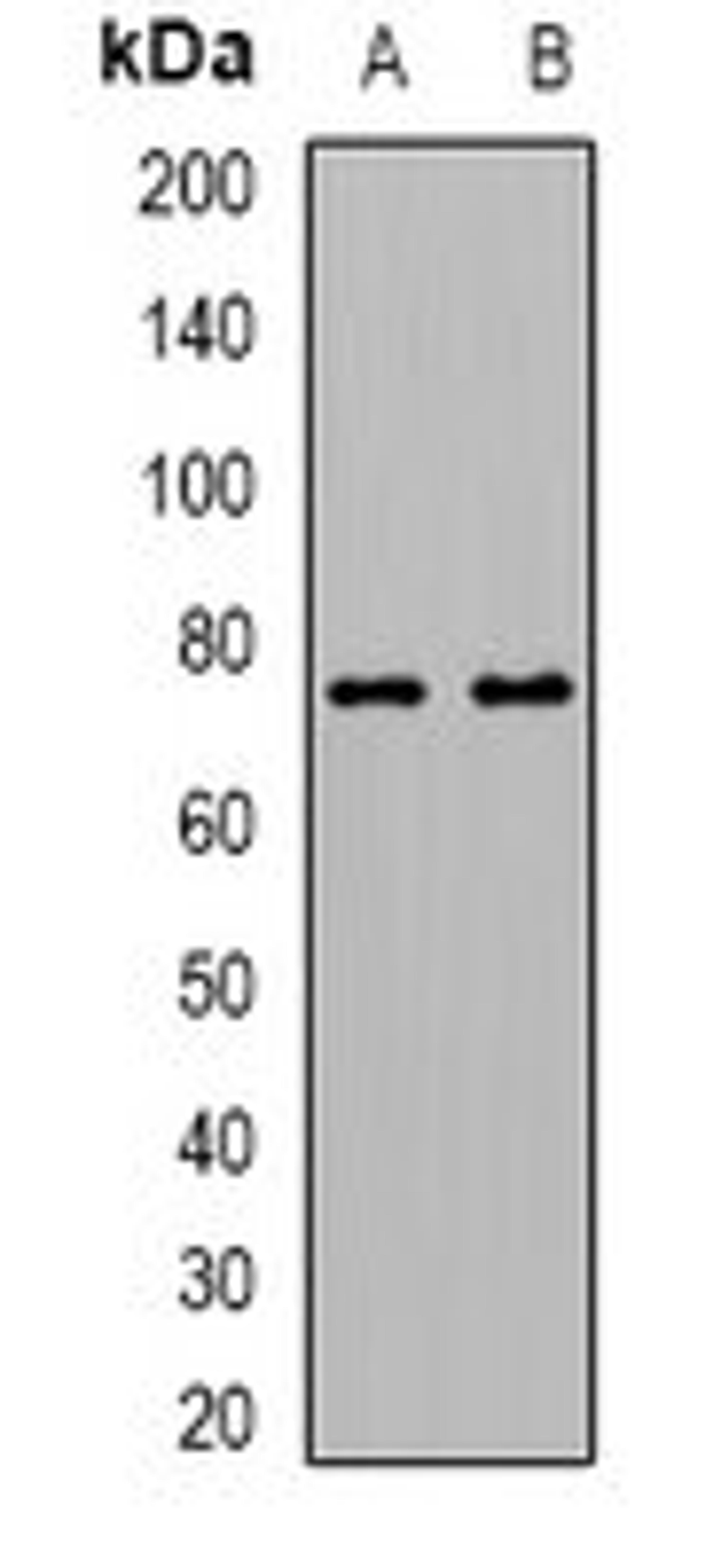 Western blot analysis of HL60 (Lane1), mouse ovary (Lane2) whole cell lysates using ALOX15B antibody