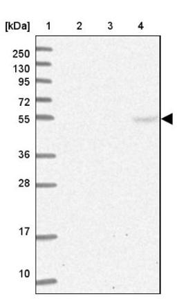 Western Blot: TRAF3IP3 Antibody [NBP1-86974] - Lane 1: Marker [kDa] 250, 130, 95, 72, 55, 36, 28, 17, 10<br/>Lane 2: Human cell line RT-4<br/>Lane 3: Human cell line U-251MG sp<br/>Lane 4: Human plasma (IgG/HSA depleted)