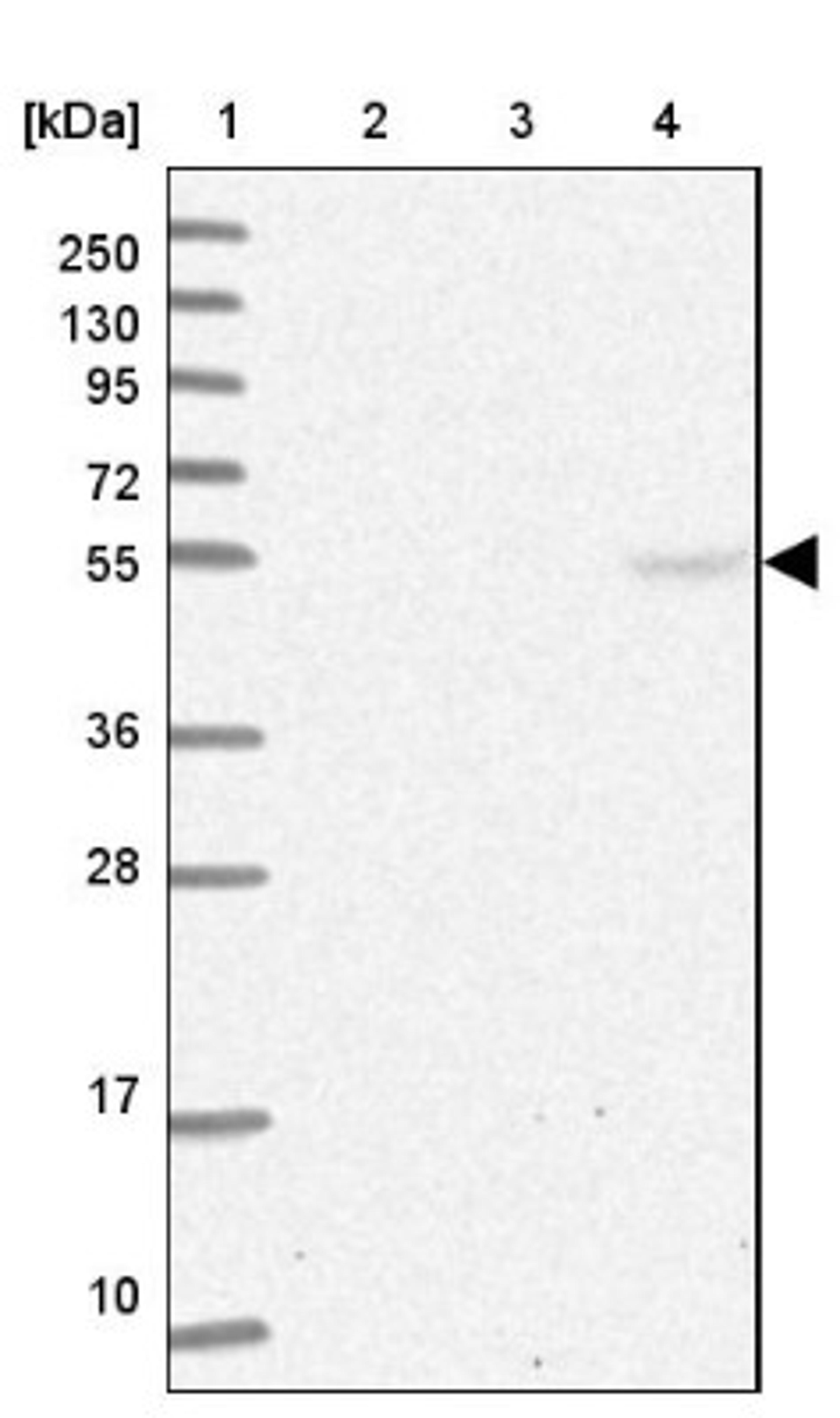 Western Blot: TRAF3IP3 Antibody [NBP1-86974] - Lane 1: Marker [kDa] 250, 130, 95, 72, 55, 36, 28, 17, 10<br/>Lane 2: Human cell line RT-4<br/>Lane 3: Human cell line U-251MG sp<br/>Lane 4: Human plasma (IgG/HSA depleted)