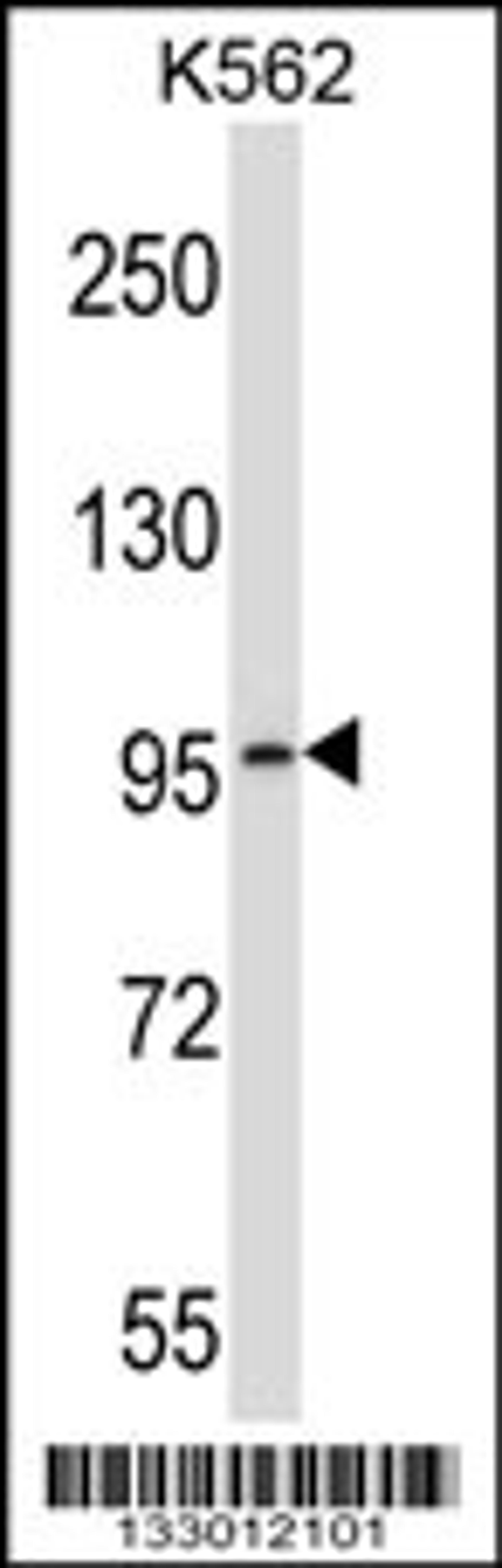 Western blot analysis in K562 cell line lysates (35ug/lane).