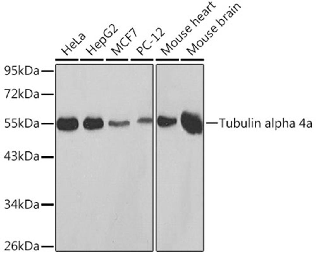 Western blot - Tubulin alpha 4a Rabbit pAb (AC014)