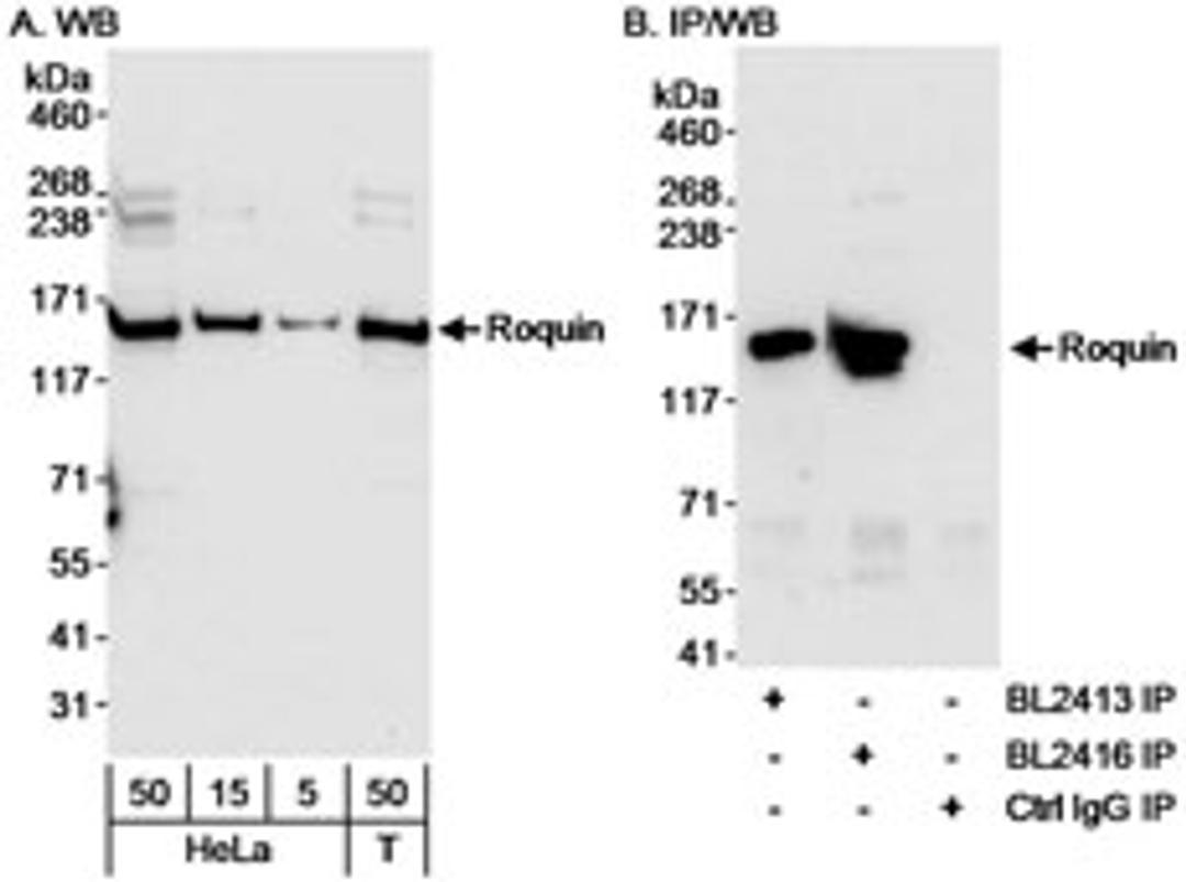 Detection of human Roquin by western blot and immunoprecipitation.