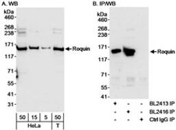 Detection of human Roquin by western blot and immunoprecipitation.