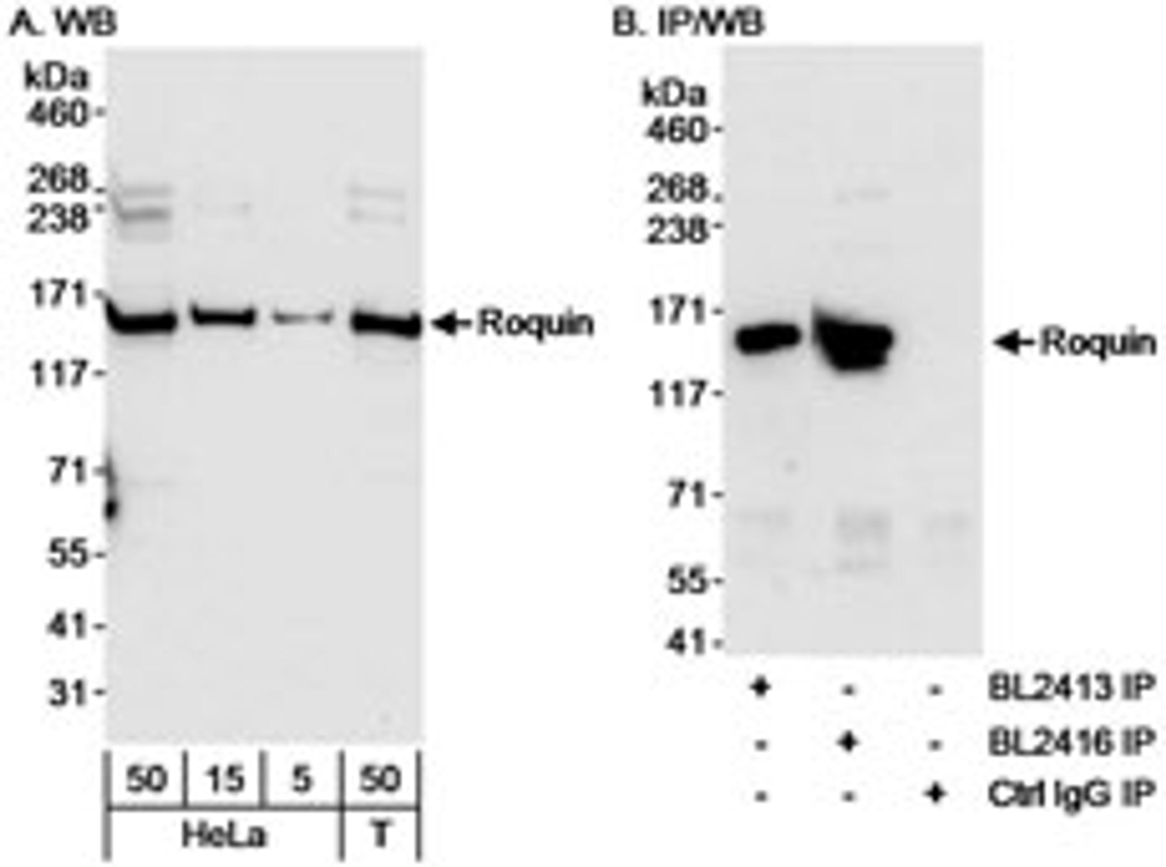 Detection of human Roquin by western blot and immunoprecipitation.