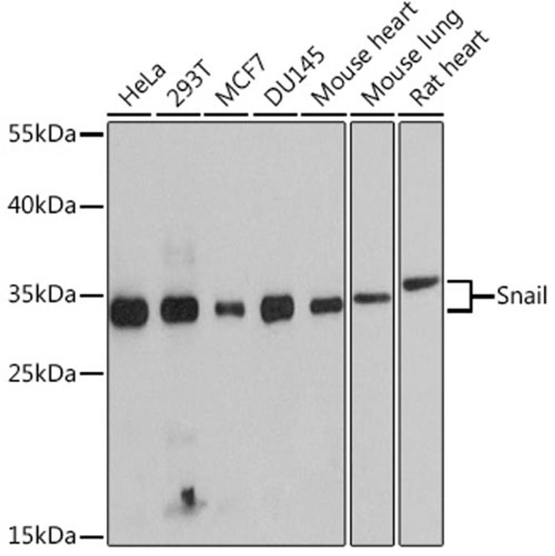 Western blot - Snail antibody (A11794)