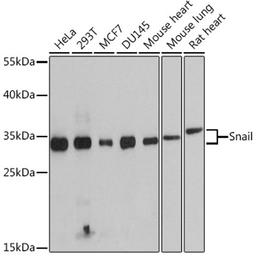 Western blot - Snail antibody (A11794)