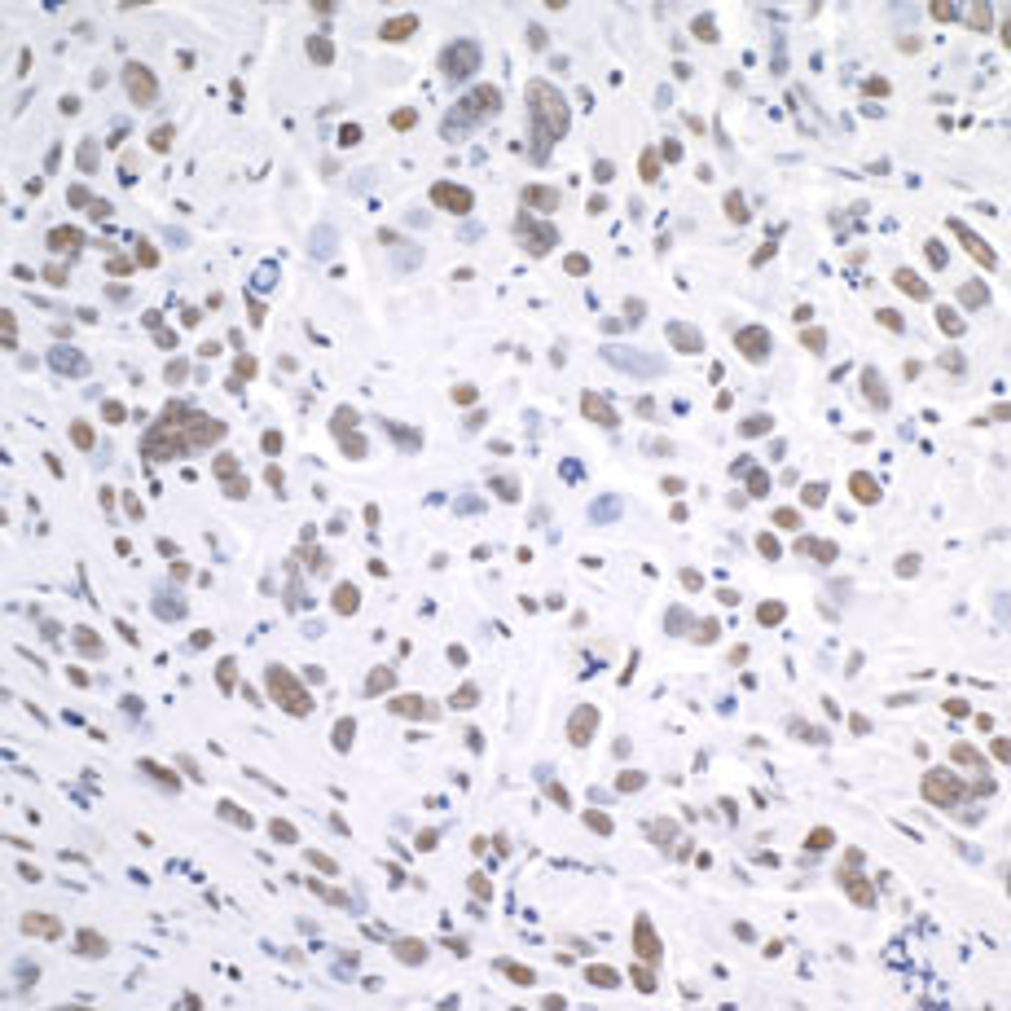 Detection of human DHX9 by immunohistochemistry.