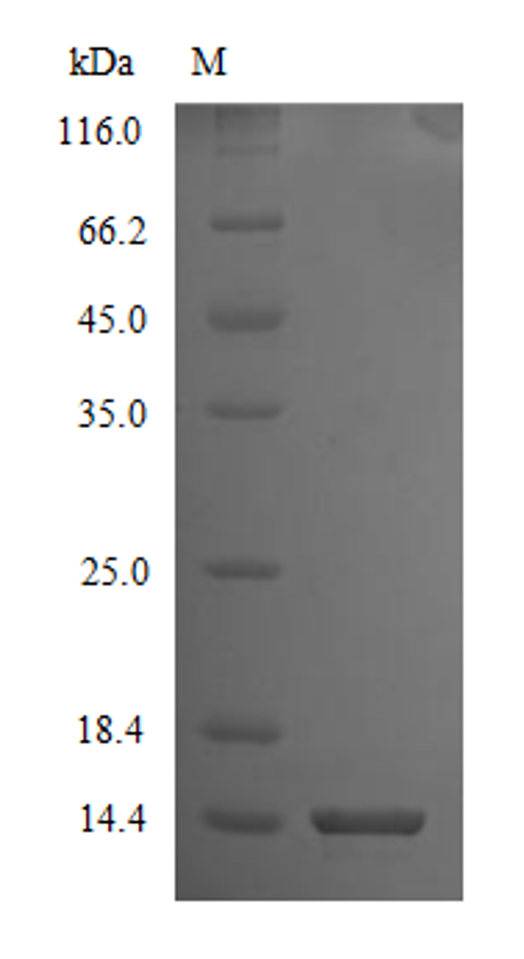 (Tris-Glycine gel) Discontinuous SDS-PAGE (reduced) with 5% enrichment gel and 15% separation gel.