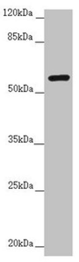 Western blot. All lanes: CEP57 antibody at 3.83µg/ml + CEM whole cell lysate. Secondary. Goat polyclonal to rabbit IgG at 1/10000 dilution. Predicted band size: 58, 55, 32, 57 kDa. Observed band size: 58 kDa