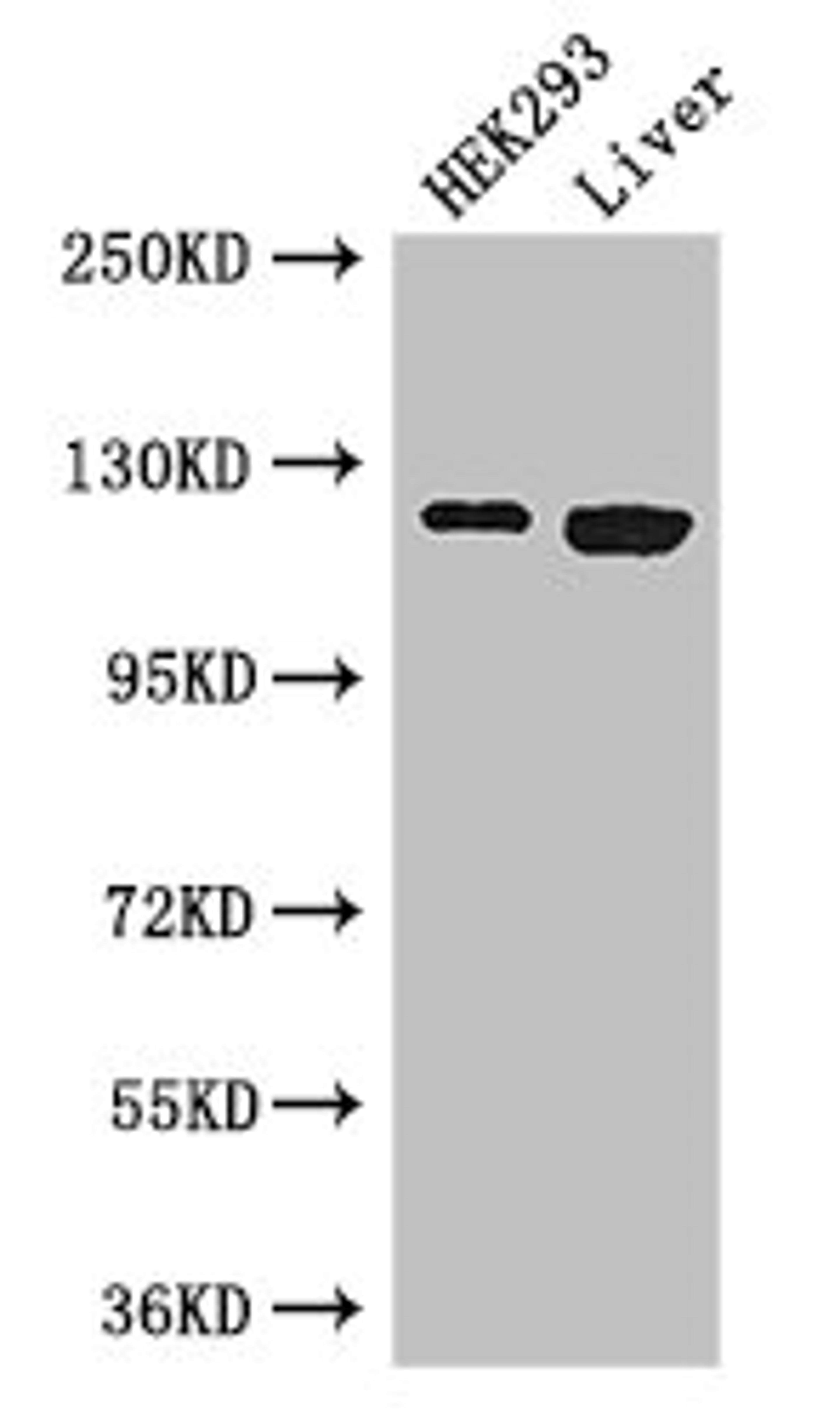 Western Blot. Positive WB detected in: HEK293 whole cell lysate, Mouse liver tissue. All lanes: PDGFRA antibody at 3ug/ml. Secondary. Goat polyclonal to rabbit IgG at 1/50000 dilution. Predicted band size: 123, 25, 83 kDa. Observed band size: 123 kDa. 
