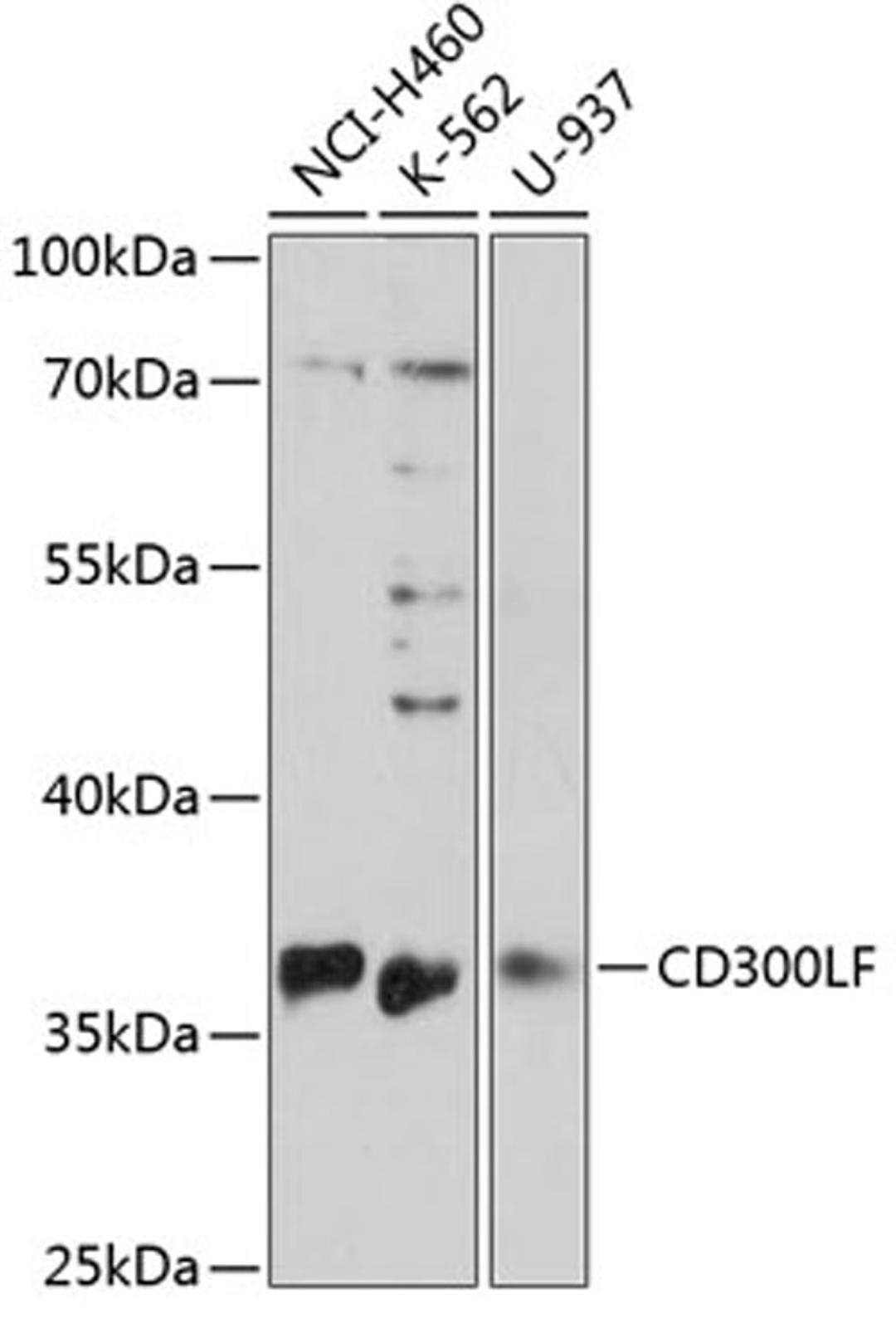 Western blot - CD300LF antibody (A13830)