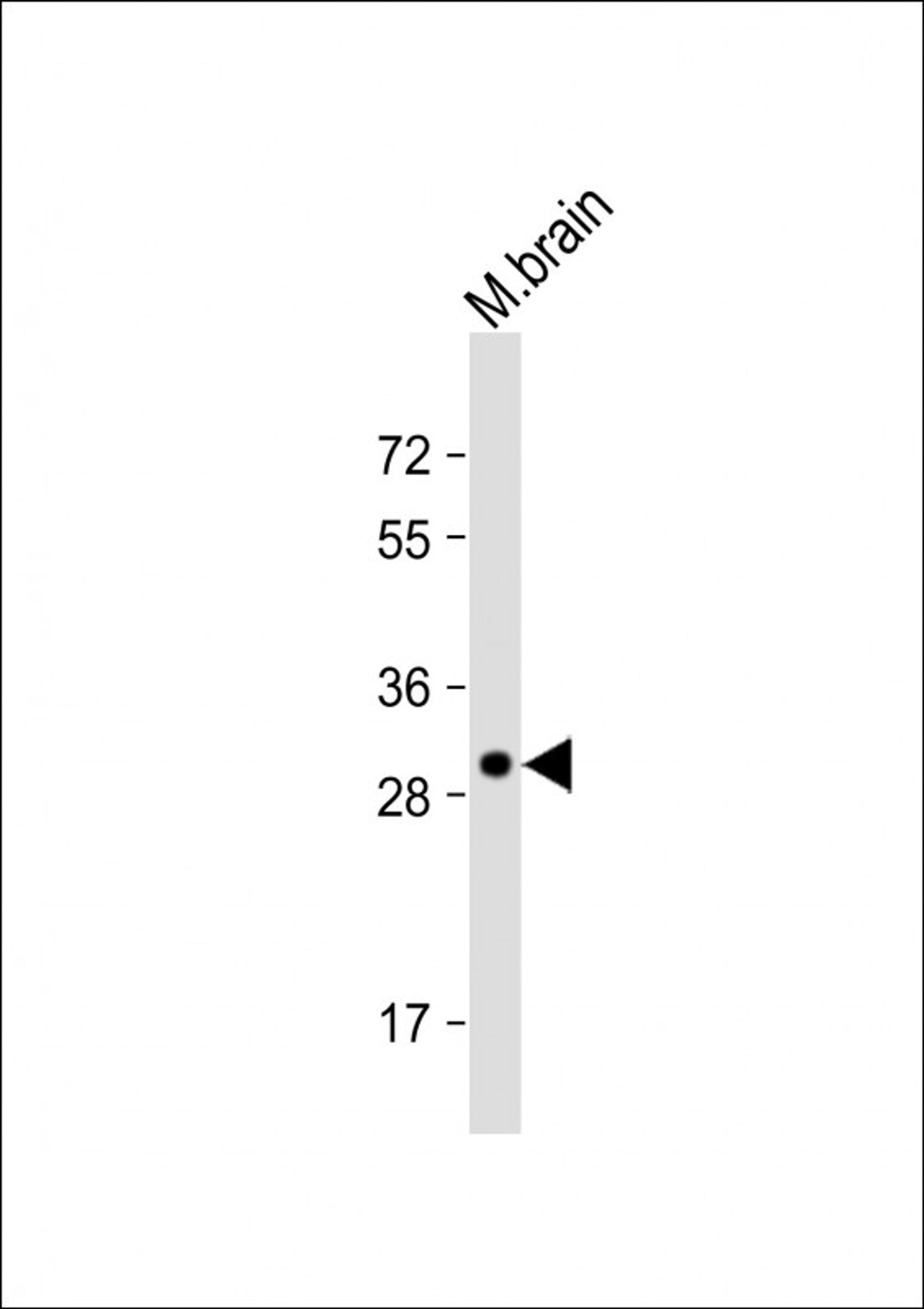 Western Blot at 1:1000 dilution + mouse brain lysate Lysates/proteins at 20 ug per lane.