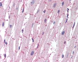 Staining of formalin fixed, paraffin embedded human heart with Rabbit anti Human ATG4B (AHP2098)