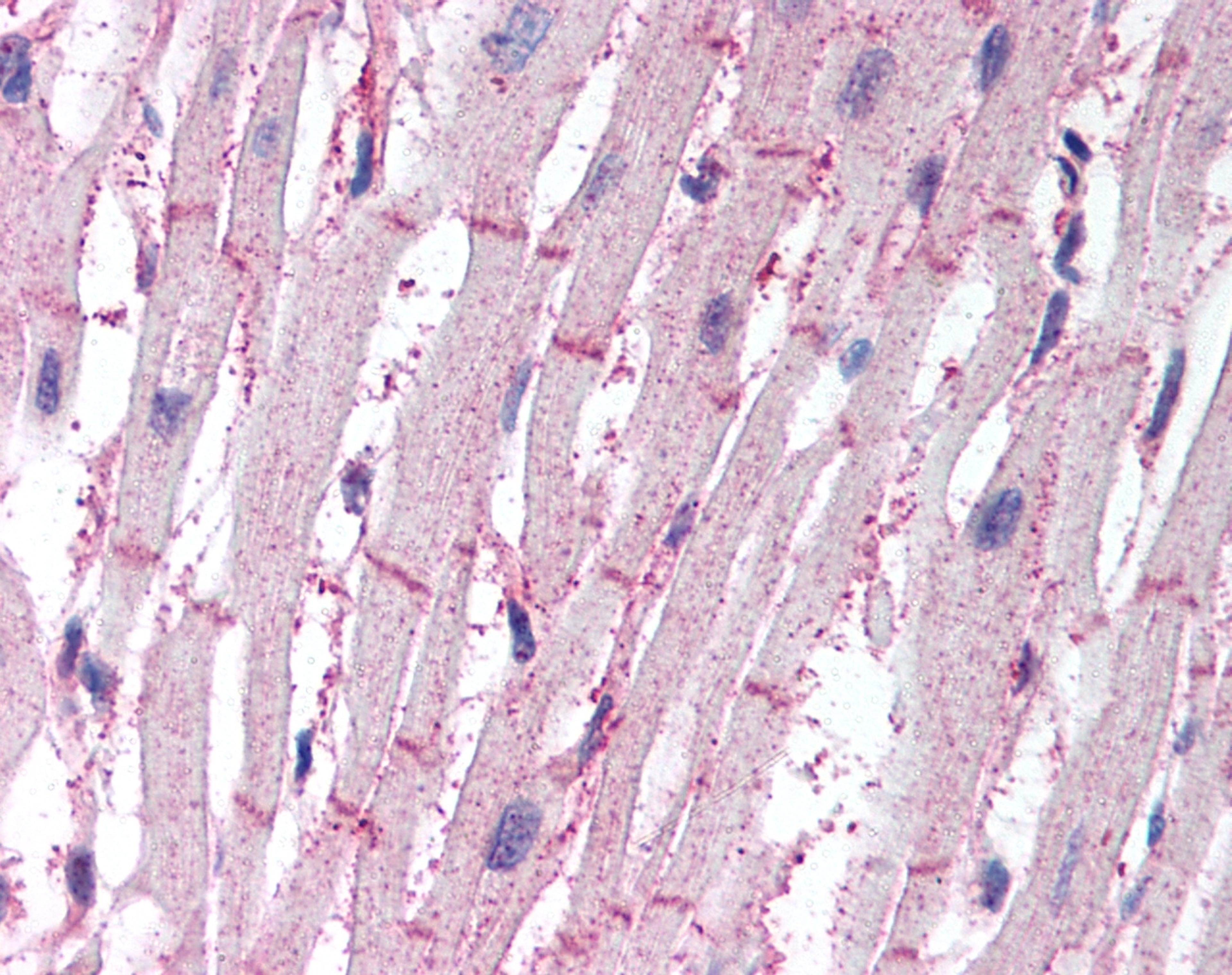 Staining of formalin fixed, paraffin embedded human heart with Rabbit anti Human ATG4B (AHP2098)