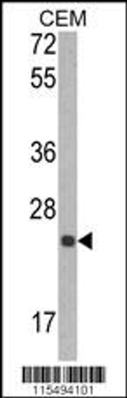 Western blot analysis of TIMP1 Antibody in CEM cell line lysates (35ug/lane)