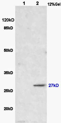 Western blot analysis of rat brain lysates(Lane1),human colon carcinoma lysates(Lane2) using Cathepsin Z antibody