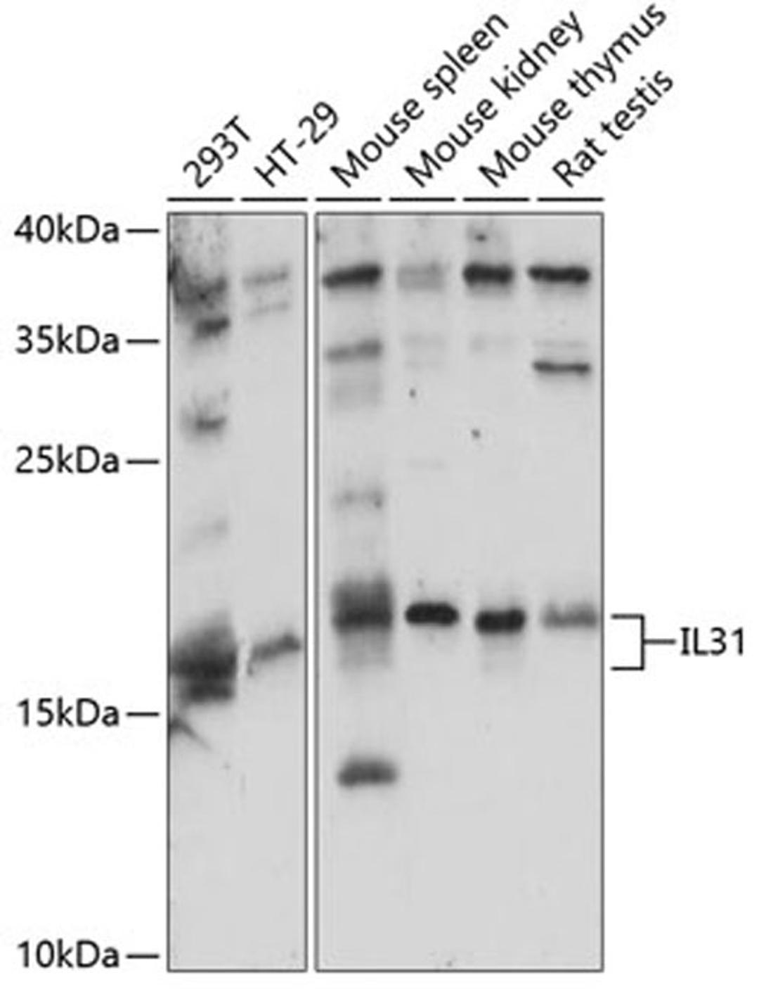 Western blot - IL31 antibody (A14982)