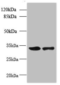 Western blot. All lanes: RWDD2A antibody at 0.2ug/ml. Lane 1: Mouse thymus tissue. Lane 2: A549 whole cell lysate. Secondary. Goat polyclonal to rabbit IgG at 1/10000 dilution. Predicted band size: 34, 28 kDa. Observed band size: 34 kDa. 