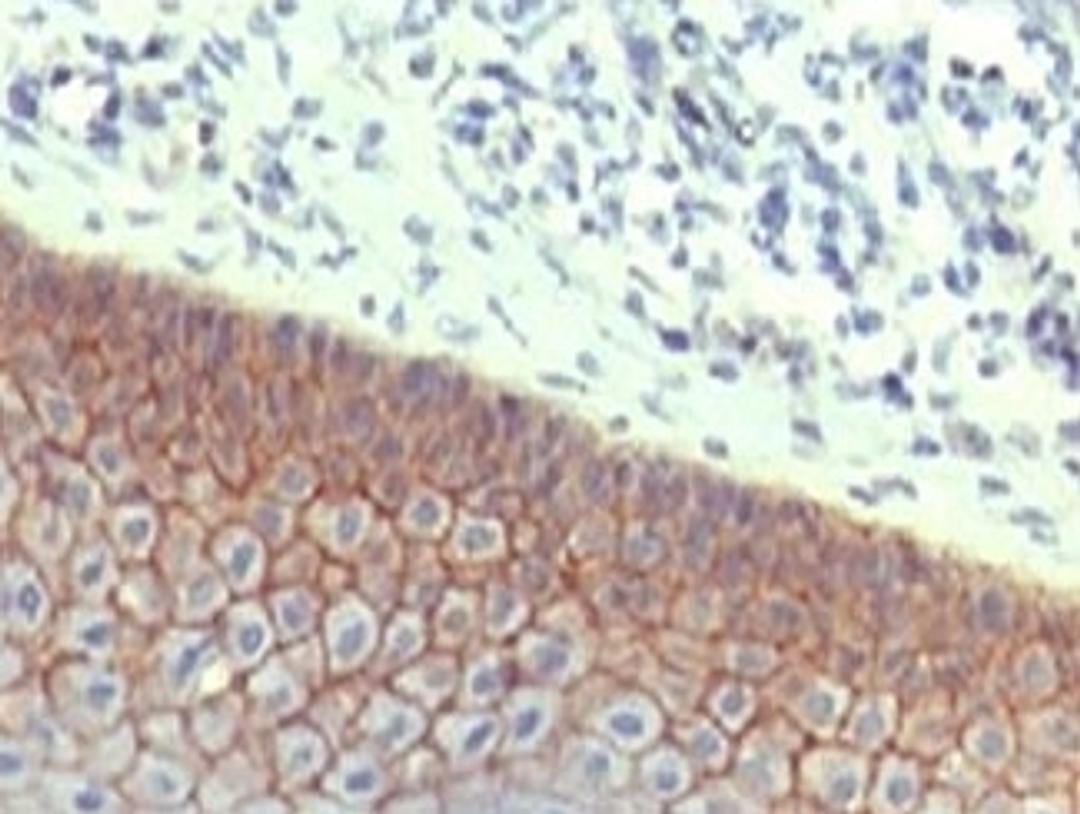 IHC testing of FFPE human skin with E-Cadherin antibody at 1ug/ml. HIER: steam sections in pH6 citrate buffer for 20 min.