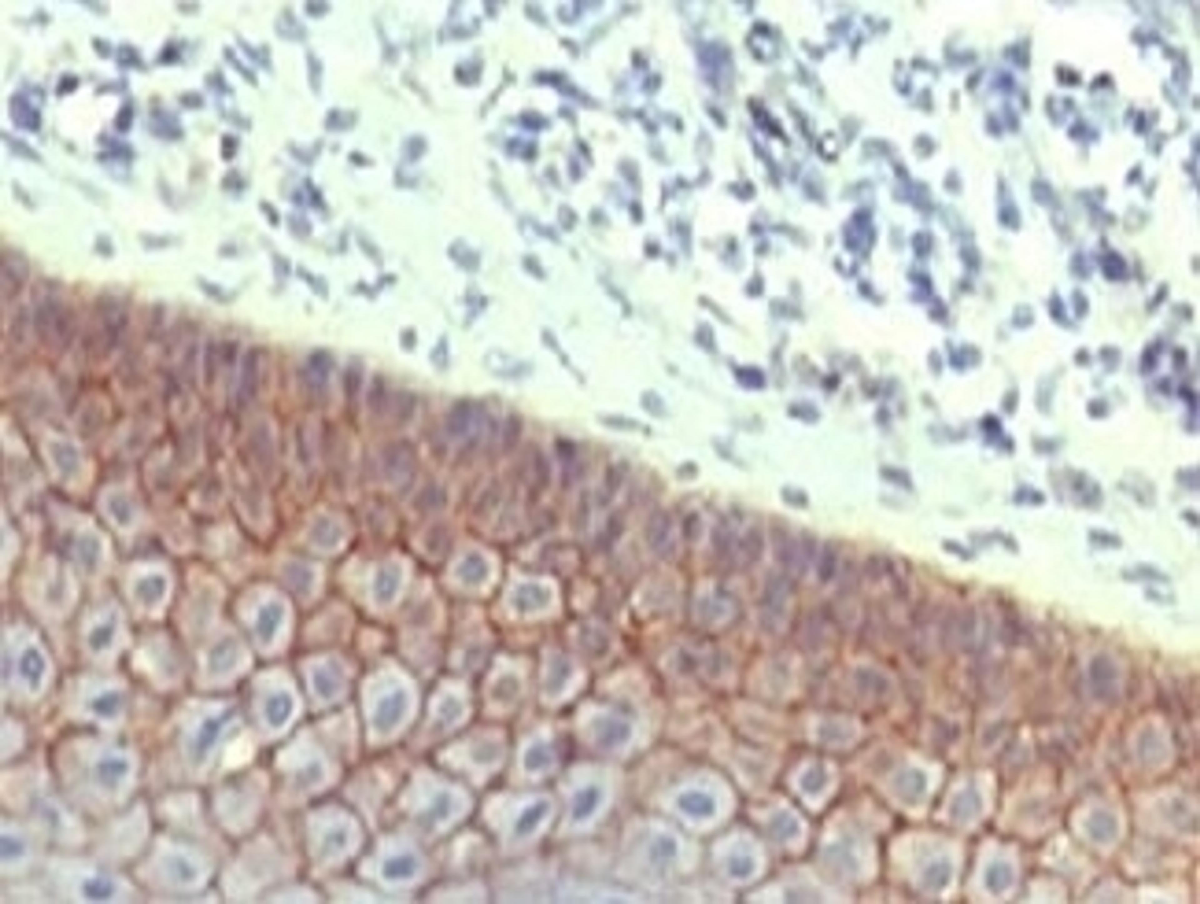 IHC testing of FFPE human skin with E-Cadherin antibody at 1ug/ml. HIER: steam sections in pH6 citrate buffer for 20 min.