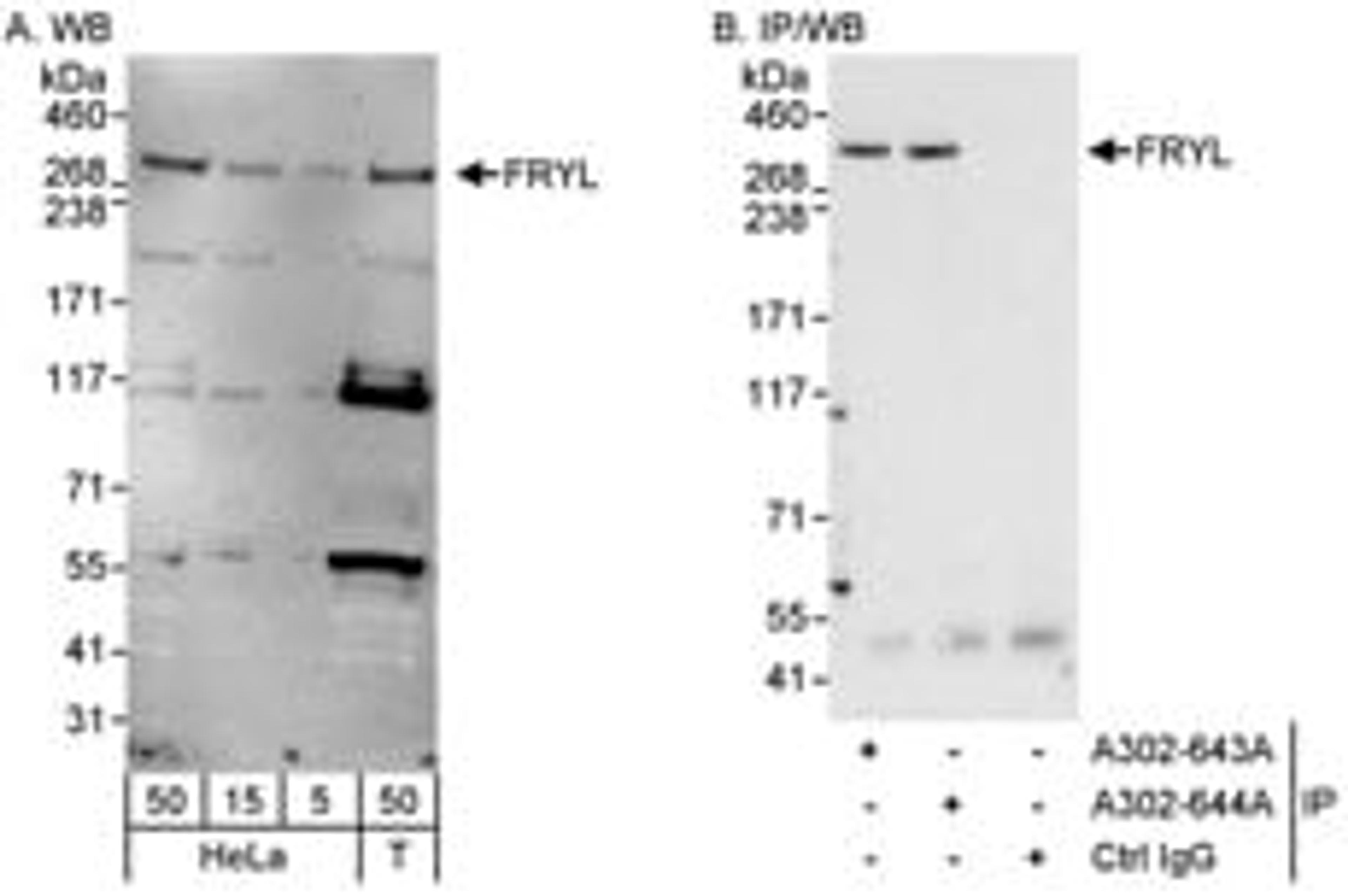 Detection of human FRYL by western blot and immunoprecipitation.