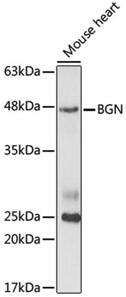 Western blot - BGN antibody (A5770)