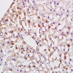 Immunohistochemical analysis of formalin-fixed and paraffin embedded rat liver tissue (dilution at:1:200) using ABCG5 antibody