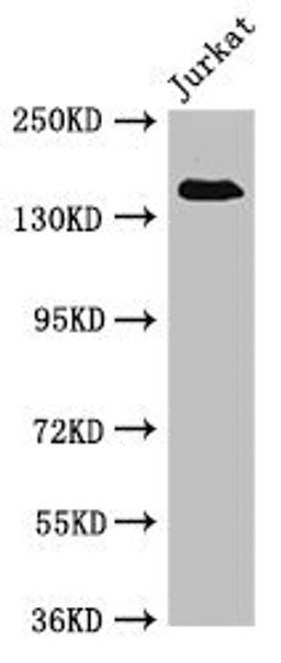 Western Blot. Positive WB detected in: Jurkat whole cell lysate. All lanes: EIF3A antibody at 4µg/ml. Secondary. Goat polyclonal to rabbit IgG at 1/50000 dilution. Predicted band size: 167, 163 kDa. Observed band size: 167 kDa