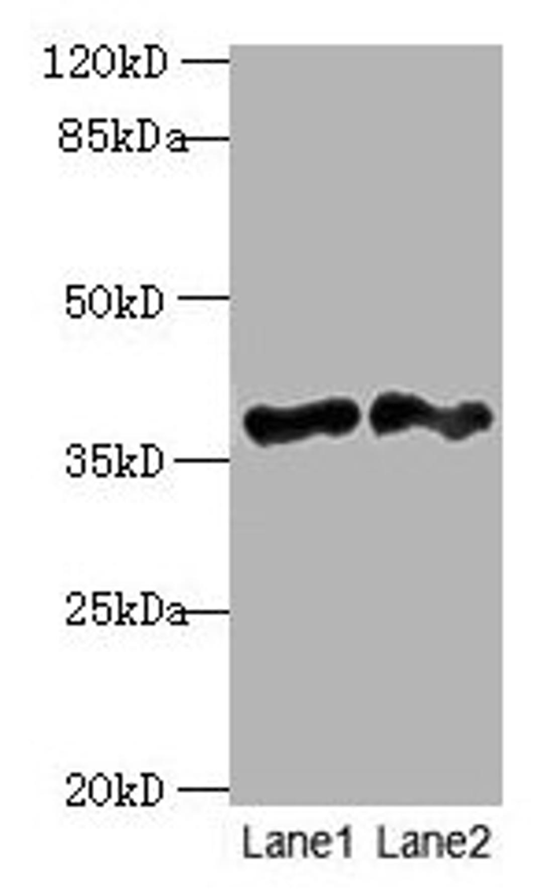 Western blot. All lanes: DNAJB4 antibody at 2µg/ml. Lane 1: Hela whole cell lysate. Lane 2: Mouse heart tissue. Secondary. Goat polyclonal to rabbit IgG at 1/10000 dilution. Predicted band size: 38 kDa. Observed band size: 38 kDa