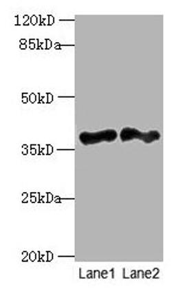 Western blot. All lanes: DNAJB4 antibody at 2µg/ml. Lane 1: Hela whole cell lysate. Lane 2: Mouse heart tissue. Secondary. Goat polyclonal to rabbit IgG at 1/10000 dilution. Predicted band size: 38 kDa. Observed band size: 38 kDa
