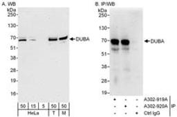 Detection of human and mouse DUBA by western blot (h&m) and immunoprecipitation (h).