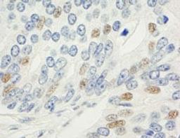 Detection of human MAD1 by immunohistochemistry.