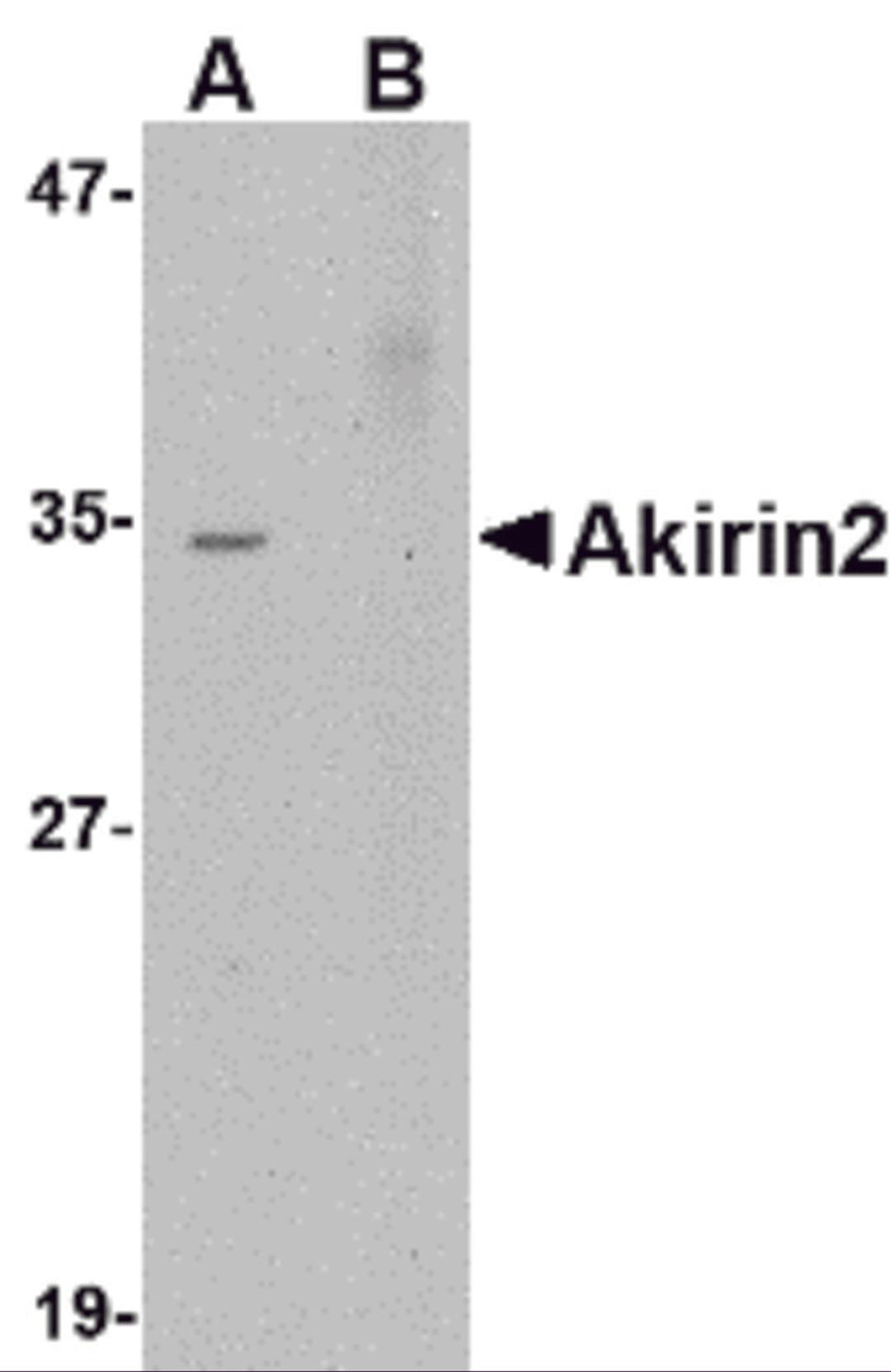 Western blot analysis of Akirin2 in Human Brain tissue lysate with Akirin2 antibody at 0.5 μg/mL in (A) the absence and (B) the presence ofblocking peptide.