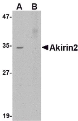 Western blot analysis of Akirin2 in Human Brain tissue lysate with Akirin2 antibody at 0.5 μg/mL in (A) the absence and (B) the presence ofblocking peptide.