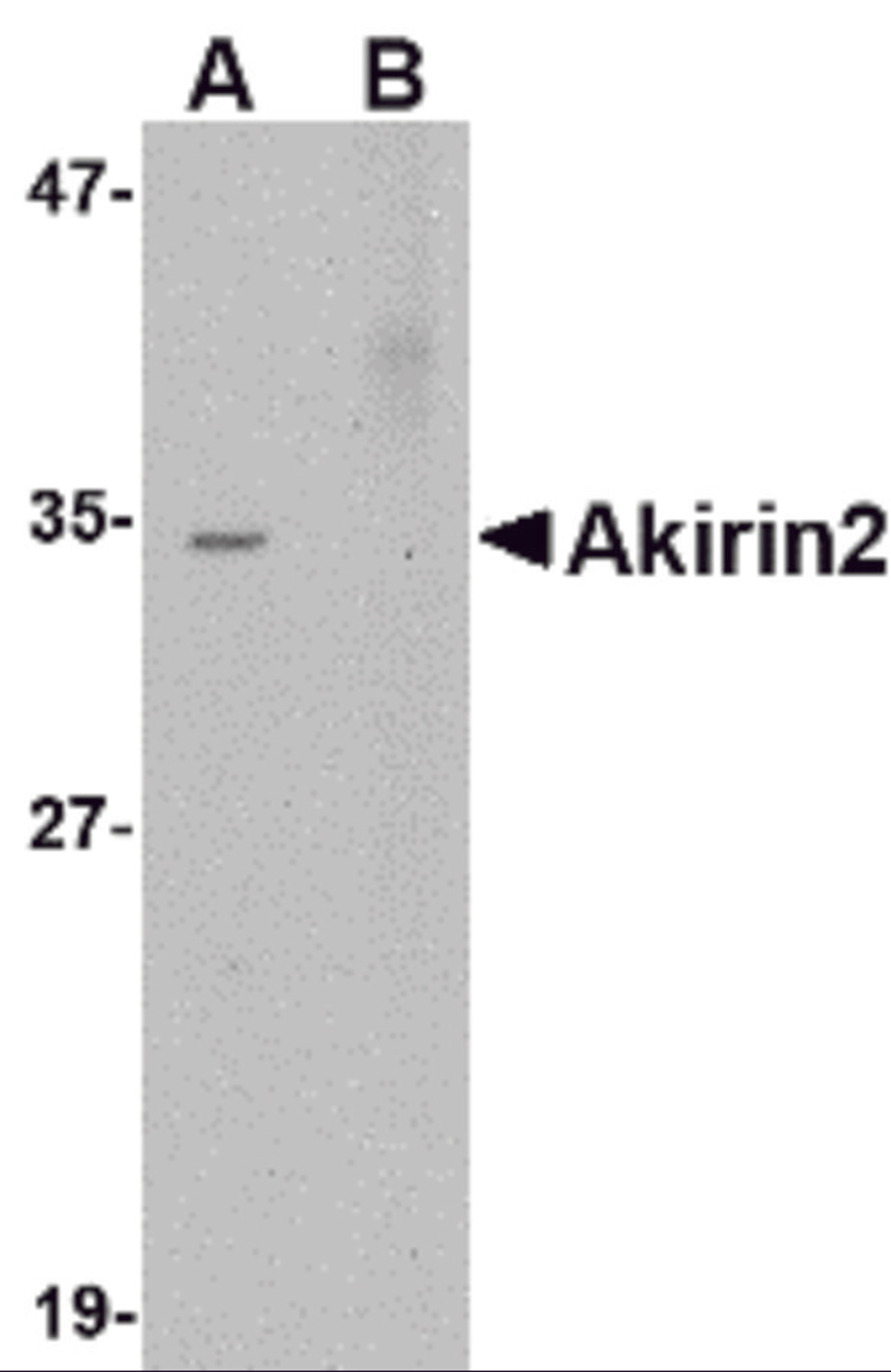 Western blot analysis of Akirin2 in Human Brain tissue lysate with Akirin2 antibody at 0.5 μg/mL in (A) the absence and (B) the presence ofblocking peptide.