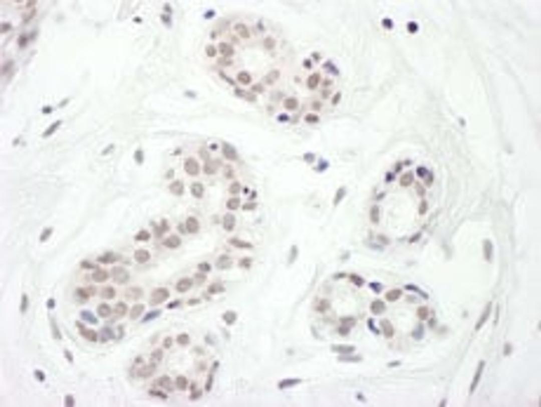 Detection of human FOXC1 by immunohistochemistry.