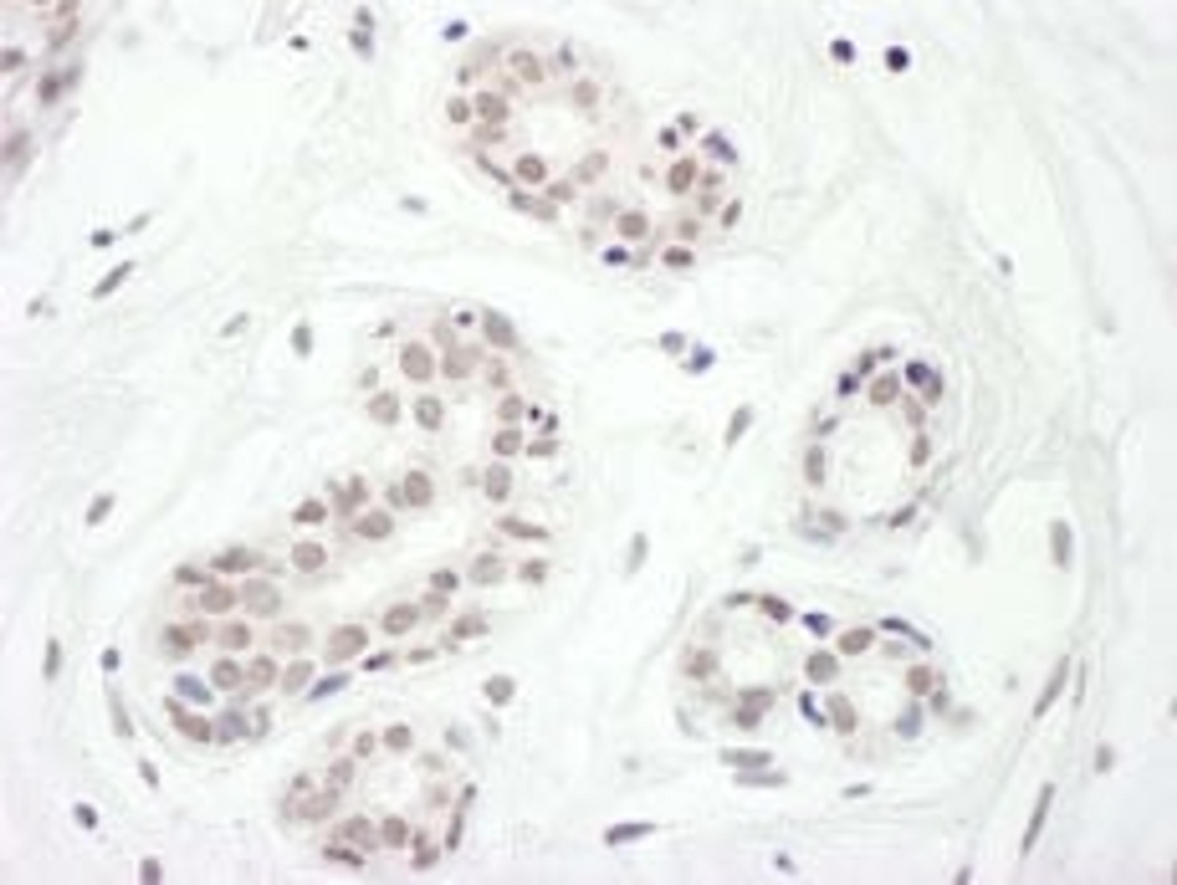 Detection of human FOXC1 by immunohistochemistry.