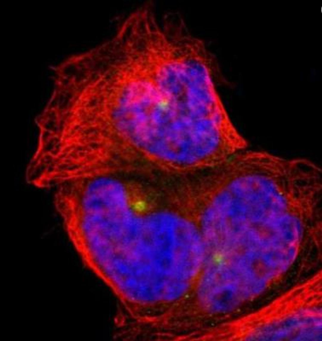 Immunocytochemistry/Immunofluorescence: PLA2G6 Antibody [NBP1-81586] - Staining of human cell line A-431 shows positivity in microtubule organizing center. Antibody staining is shown in green.