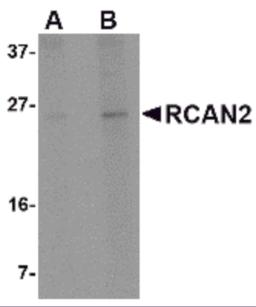 Western blot analysis of RCAN2 in 3T3 cell lysate with RCAN2 antibody at (A) 1 and (B) 2 &#956;g/mL.